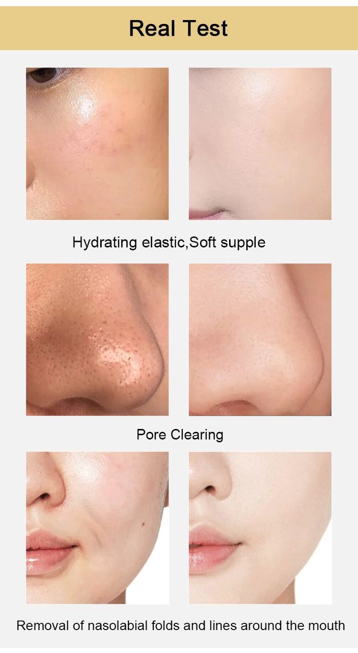 Golden Peel-Off Facial Mask (Buy 1 Get 3 Free)π₯